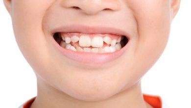 Photo of Các mẹ cần biết những “thủ phạm” khiến răng trẻ mọc lệch để có thể điều chỉnh kịp thời