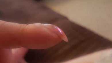 Photo of Cảnh giác nguy cơ mắc ung thư phổi qua những dấu hiệu của ngón tay