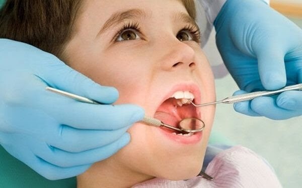 Sâu răng ở trẻ nhỏ và cách phòng ngừa hiệu quả