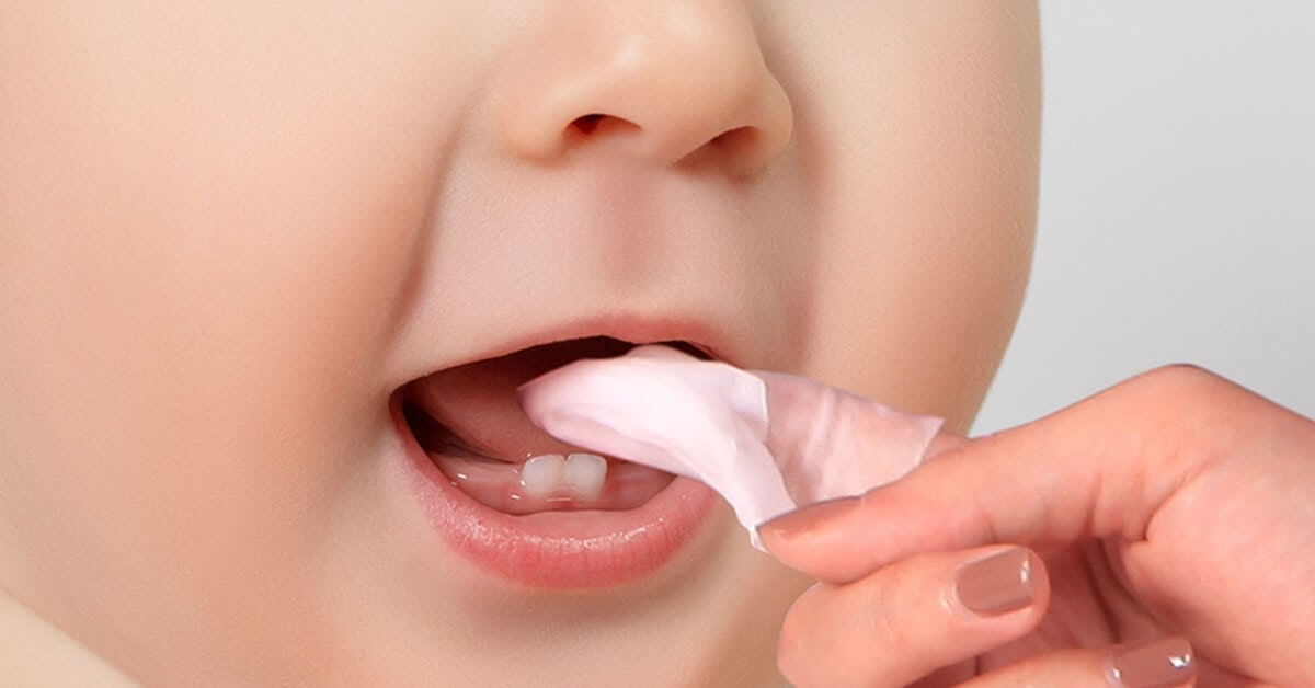 Chuyên gia tư vấn cách vệ sinh miệng lưỡi cho trẻ